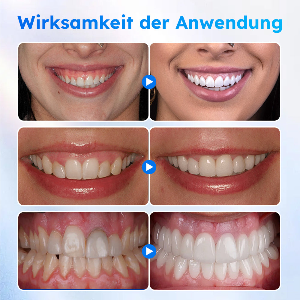 Furzero™ Oral Gel zur Zahnfleischbehandlung