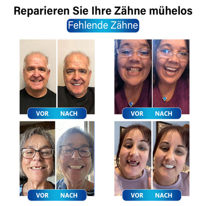 ✅Offizieller Shop | Instant Smile™ Blaulicht-Härtungslampe und Zahnersatzmaterialien✅CE-Kennzeichnung erhalten(Zur Reparatur von fehlenden Zähnen, gebrochenen Zähnen und Zahnlücken)🏥🏥