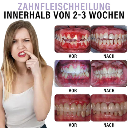 ✅Offizieller Shop | Instant Smile™ Nelkenöl Mundpflege-Spray🧑🏼‍⚕️Zertifiziert von der Deutschen Zahnärztekammer