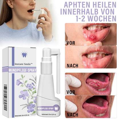 ✅Offizieller Shop | Instant Smile™ Nelkenöl Mundpflege-Spray🧑🏼‍⚕️Zertifiziert von der Deutschen Zahnärztekammer