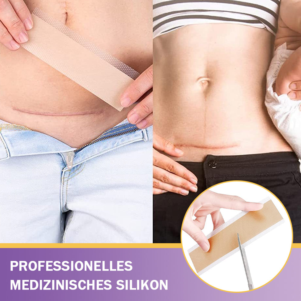 ✅Offizieller Shop |Ourlyard® Hyaluronsäure-Nano-Mikronadel-Reparaturpflaster🦅☑️(Behandlung von alten und neuen Narben, Reduktion von Operationsnarben, Dehnungsstreifen, Keloiden, Akne, Verbrennungen, Warzen, Hautverletzungen und Krampfadern.)