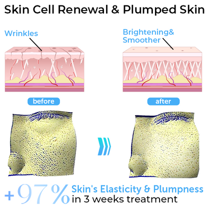 GFOUK™ EMSculpt Schlafendes V-Gesicht Schönheitsgerät