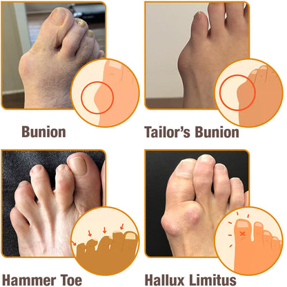 flysmus™ Hallux-Care Bienengift-Behandlungscreme