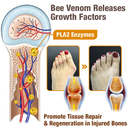 flysmus™ Hallux-Care Bienengift-Behandlungscreme